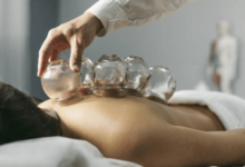 Understanding Cupping Massage Therapy: Benefits and Drawbacks