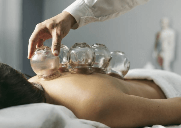 Understanding Cupping Massage Therapy: Benefits and Drawbacks