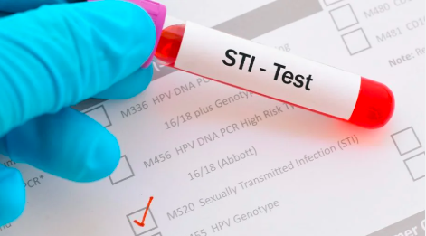 STD Testing