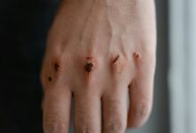 qexilkizmor safety for sensitivity