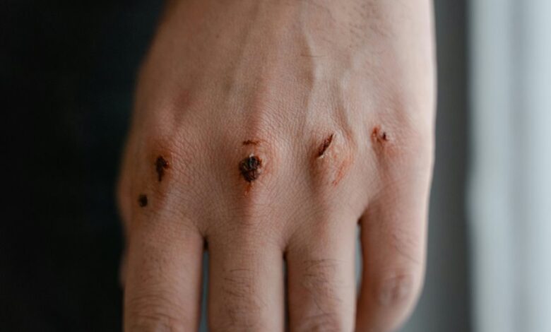 qexilkizmor safety for sensitivity